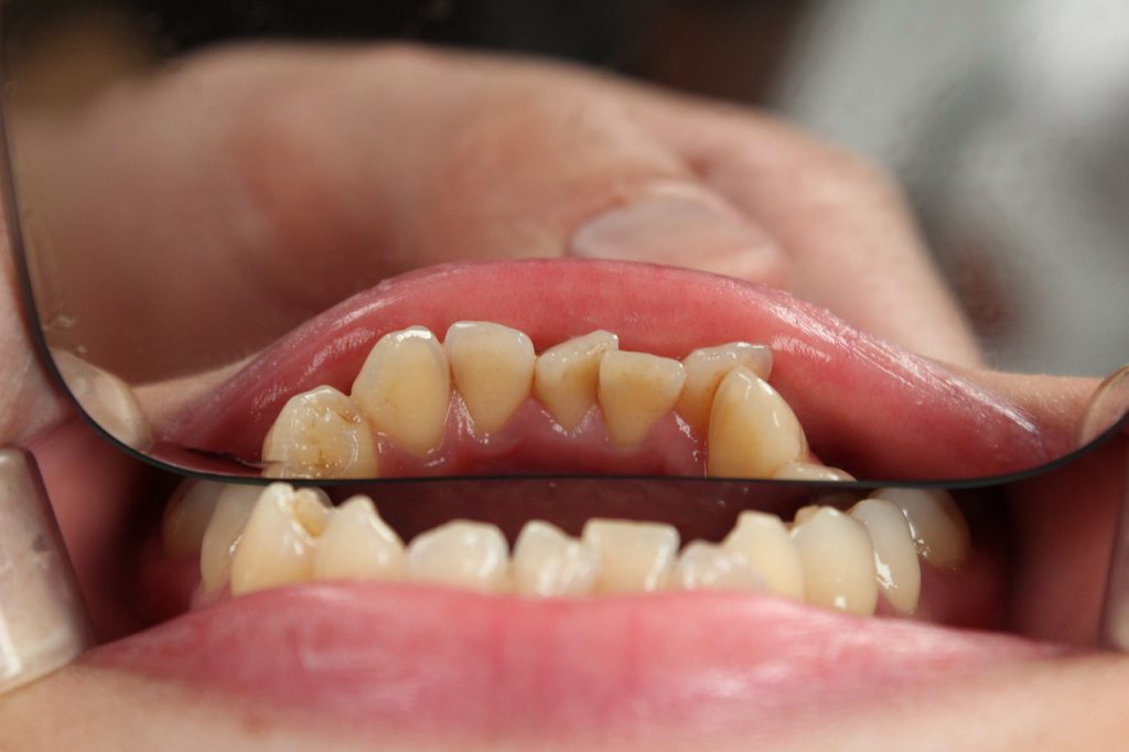 zęby, dentysta, ortodonta